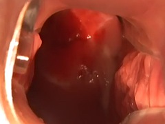 Blasen, Braunhaarige, Klaffend, Gynäkologe, Lingerie, Pov, Jungendliche (18+), Spielzeuge