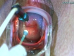 Cul, Blonde, Dingue, Médecin, Exam, Fétiche, Gyneco, Insertion