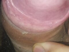 19-year-old boy's penis with a pink head