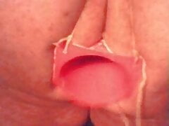 Old Anal stretching  clip (plastic cone)