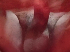 Crimey chisels in forearm job in guest room