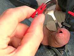 Estim & sounding with a spoon & hegar 11mm sound 3rdh box