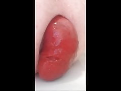 My small prolapse