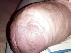 2liter glucose 'halfeway' of my double injection