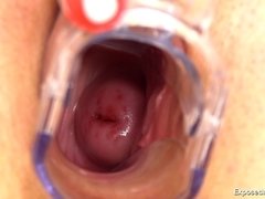 Brunette brune, Masturbation, Infirmière, Chatte, Solo, Jouets