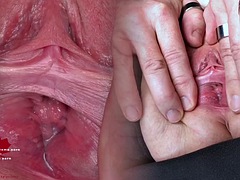 Fetisch, Fingern, Flashen, Klaffend, Deutsch, Gynäkologe, Milf, Muschi