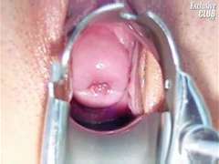Sadomasoquismo, Médico, Examen, Ginecologo