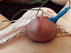 E stim