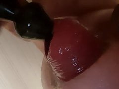 Pulling hole to prolapse