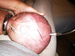 Kinky filling up again with glucose