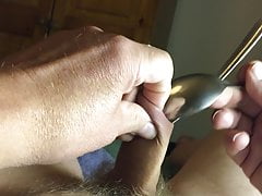 18 metal spoons in foreskin
