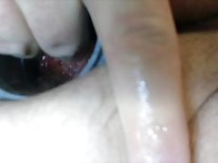 prolapse rosebud buttplug