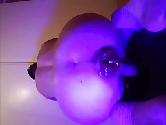 Prolapse