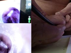 camera endoscopy of my cock