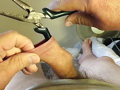 Foreskin with small blue pliers