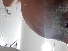 Fisting and prolapse