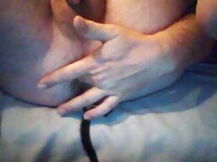 anal test