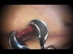 Shemale anal speculum and dildo transvestite 49