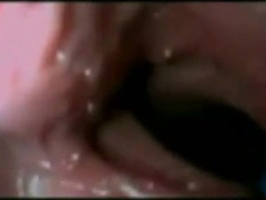 This is what happens inside your ass - delightful? 3