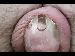 Prostate Milking 20 - 26th October 2020