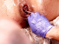 Punched into a mans hole