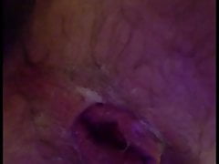 My Stretched Ass Has Pussy Lips