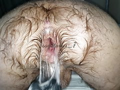 Hairy Ass Prolapse Hole