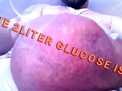 Filling up with 2 liters glucose