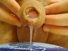 Foreskin cock precum after prostate milking