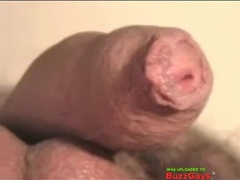 ON THE RISE (A BALLS-EYE-VIEW) 2