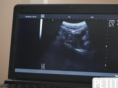 Wooly lad barebacked by urologist after medical examination