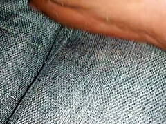 Deadskin on my soles and fingers