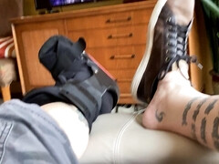 broken leg fetish