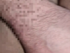 Rectal rail compilation