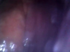 Deep look inside cum filled ass with endoscope