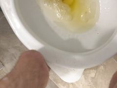 Guy With Cerebral Palsy has Massive Load of Pee for You