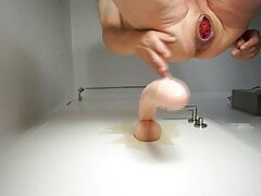 Rose Bud - Prolapse Party #2