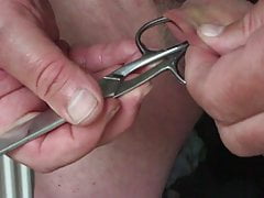 Foreskin with a potato and scissors