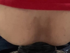 FAT DILATION OF THE WOLVETTER