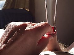 Sunshine foreskin - 4 of 8