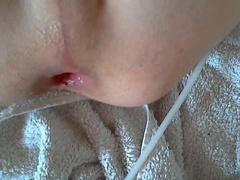 First Time Knotting My BD Toy - Gaping Twink